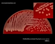 mrsa colonies on blood agar